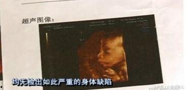 产检真实视频,宝宝在母体内的真实影像记录