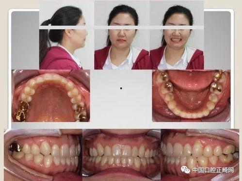 成年女人性视频